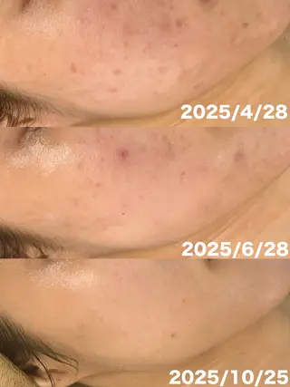 WHITE AQUA 北千住店のエステ・リラクイメージ