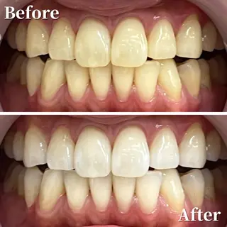 LBSホワイトニング 銀座店💎公式のその他イメージ