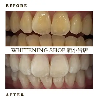 メンズ ホワイトニング ショップ新小岩店のその他イメージ