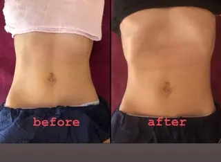 ❤︎MN❤︎ モンのエステ・リラクイメージ