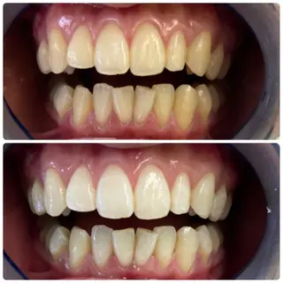 PLATINUM Beauty 横浜店所属・ホワイトニングルーム 横浜店のその他イメージ