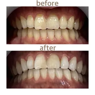 メンズ ホワイトニング ショップ船橋店のエステ・リラクイメージ