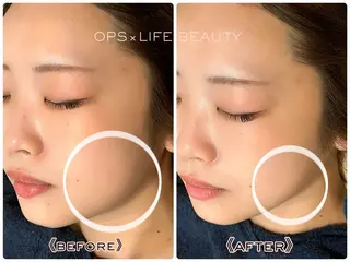 メンズ OPS×LIFE BEAUTY所属・OPS×LIFE BEAUTY/maiのエステ・リラクイメージ