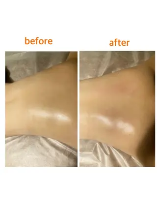 bellissimo 【ベリッシモ】所属・ちひろ　痩身/ハーブ bellissimoのエステ・リラクイメージ