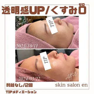 skin salon en所属・skin salon enのエステ・リラクイメージ