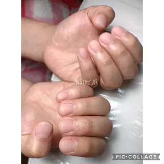 ネイル Nail ビ爪のネイルデザイン