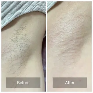 Salon Improveのネイルデザイン