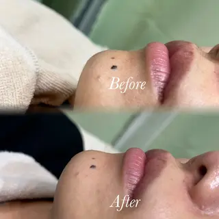 🫧美しい素肌へ🫧 今成柚乃のその他イメージ