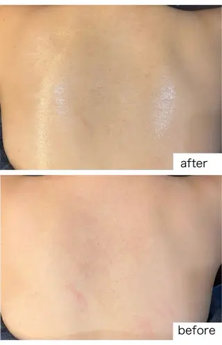 leolo武蔵浦和 肌質改善&脱毛のエステ・リラクイメージ