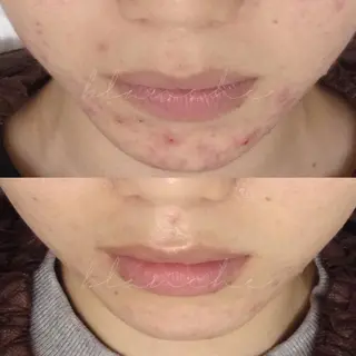 セミロング カラー パーマ ヘアアレンジ ネイル マツエク・マツパ アイブロウ 都度払い肌質改善 &脱毛Blancheのエステ・リラクイメージ