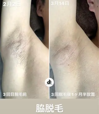 メンズ Beauty Salon MARU所属・新潟市メンズ【脱毛】 MARUのエステ・リラクイメージ