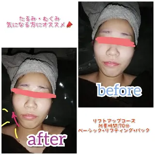 Alphaplus AYAMI のエステ・リラクイメージ