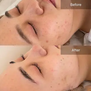 salon de perfectionのエステ・リラクイメージ