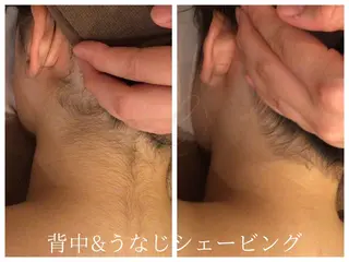 Beauty salon Lino所属・美肌特化の イオン導入脱毛のエステ・リラクイメージ