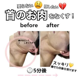 stella所属・stella都度払い 痩身小顔まつげパーマのマツエク・マツパデザイン