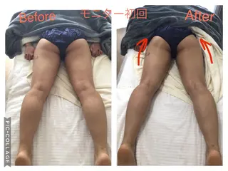 子宮矯正/腸揉み/ シュガーリング脱毛のエステ・リラクイメージ