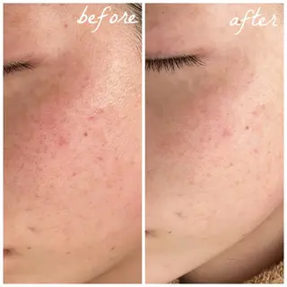 メンズ メナード岐阜茜部 杉浦のエステ・リラクイメージ