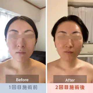 眉毛×小顔矯正サロン パピヨンsakiのエステ・リラクイメージ