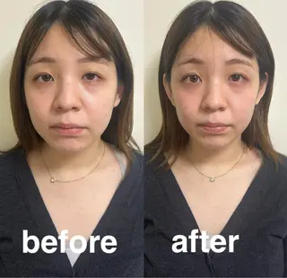 美容鍼灸サロン mahoroba院長のエステ・リラクイメージ