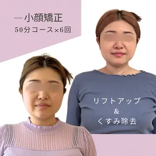 小顔と美肌をつくる サロンLUCYのエステ・リラクイメージ