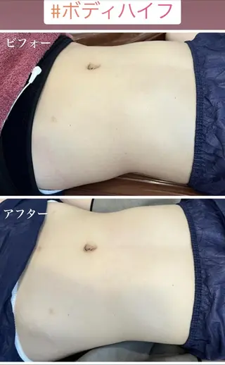 FLEUR大阪・整体 ・ハイフ・痩身・小顔のエステ・リラクイメージ