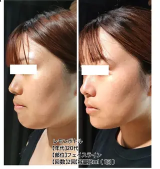 ベルーテ エッセンスのエステ・リラクイメージ