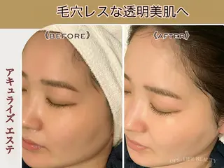 メンズ OPS×LIFE BEAUTY所属・OPS×LIFE BEAUTY/maiのエステ・リラクイメージ