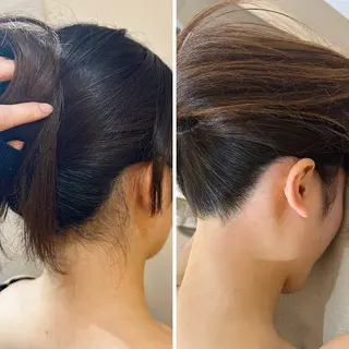 うなじ脱毛/美肌脱毛 LABELのエステ・リラクイメージ