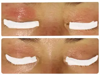 ピーリングサロン シャンテール所属・ピーリングサロン シャンテールのエステ・リラクイメージ