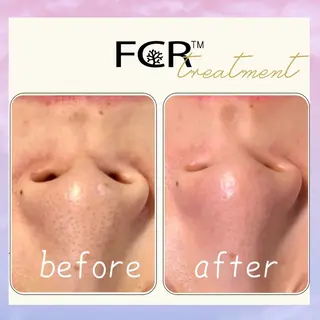 肌質改善Charme coco  みさのエステ・リラクイメージ