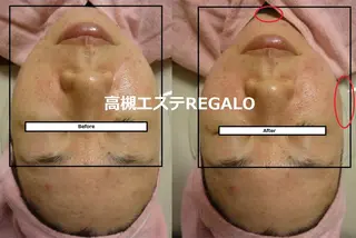 REGALO所属・矢野 さやかのエステ・リラクイメージ