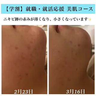 Bellesthe (ベルエステ)のエステ・リラクイメージ