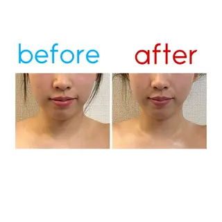 韓国式フェイシャルサロンanela所属・水田 早紀のその他イメージ