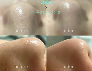 脱毛/毛穴ケア/小顔 博多アンドナイン平尾の眉毛・アイブロウイメージ