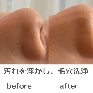 最速小顔・肌質管理 ❣️エスポワールのエステ・リラクイメージ