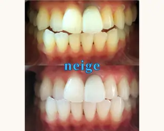 ホワイトニングサロン ネージュ(女性専用)のその他イメージ