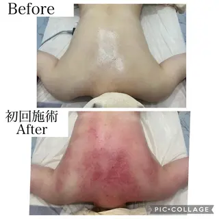 ブライダル痩身×脱毛 尼崎駅前サロンのエステ・リラクイメージ