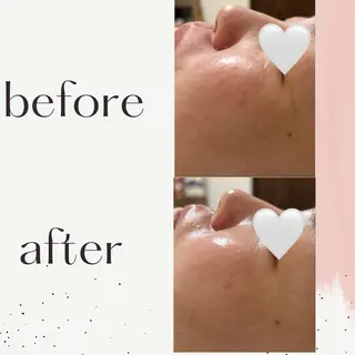 ESTHETIC SALON milulu所属・大栁 晶子のエステ・リラクイメージ
