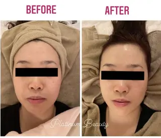 プラティーヌ ボーテ【もものり】のその他イメージ