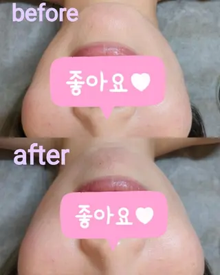 プライベートサロン宿り木所属・江坂@宿り木 脱毛& 耳ツボジュエリーのその他イメージ