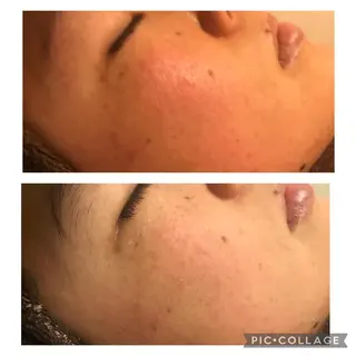 ミディアム カラー パーマ ヘアアレンジ メンズ キッズ ネイル マツエク・マツパ アニメ,Vオタク× 即効痩せエステサロンのエステ・リラクイメージ