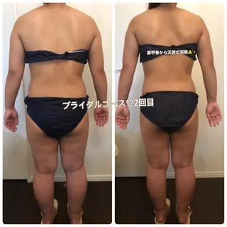 FLEUR大阪・美容 整体・痩身・小顔のエステ・リラクイメージ