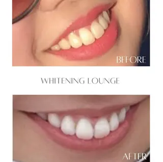 ホワイトニングラウンジ横須賀所属・ホワイトニング Lounge横須賀のその他イメージ