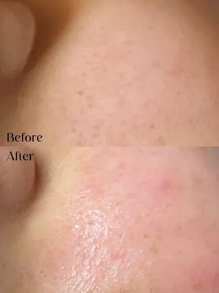 Hit. シュガーリング豊橋のエステ・リラクイメージ