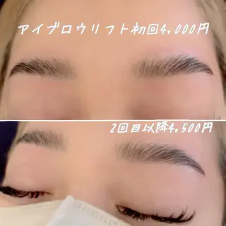 アイブロウ エステ.まつげ.小顔 眉毛.プラズマ.脱毛のマツエク・マツパデザイン