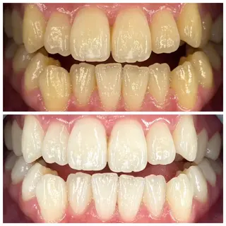 SELFMADE 高崎店の眉毛・アイブロウイメージ