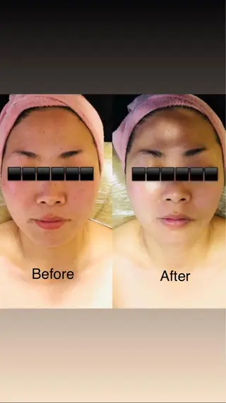 筋膜リリース専門サロン パラ・ディ所属・パラ・ ディのエステ・リラクイメージ