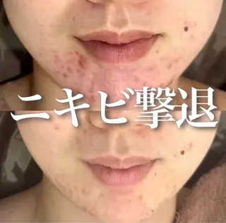 WHITE AQUA 北千住店のエステ・リラクイメージ