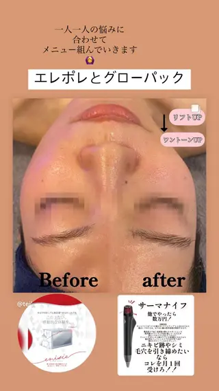 TEIKOKU所属・トータルビューティー TEIKOKUのエステ・リラクイメージ