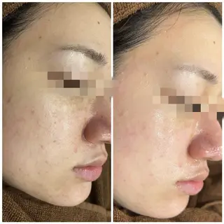 カラー パーマ ヘアアレンジ メンズ キッズ ネイル マツエク・マツパ アイブロウ Amaryllis 🌹松本のエステ・リラクイメージ